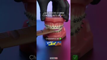 ¿Que comer con brackets en ?? ? - Odontología Láser #Shorts